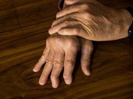 Psoriatic Arthritis Treatment Symptoms, Living With