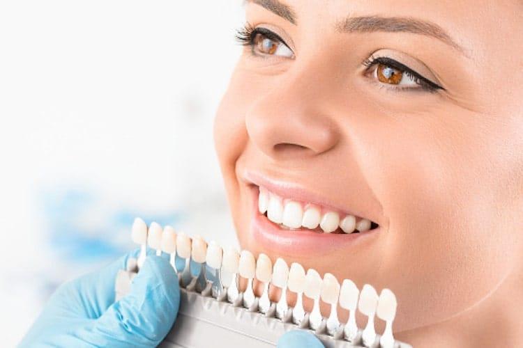How Do I Care For My Teeth After Using A Teeth Whitening Kit?
